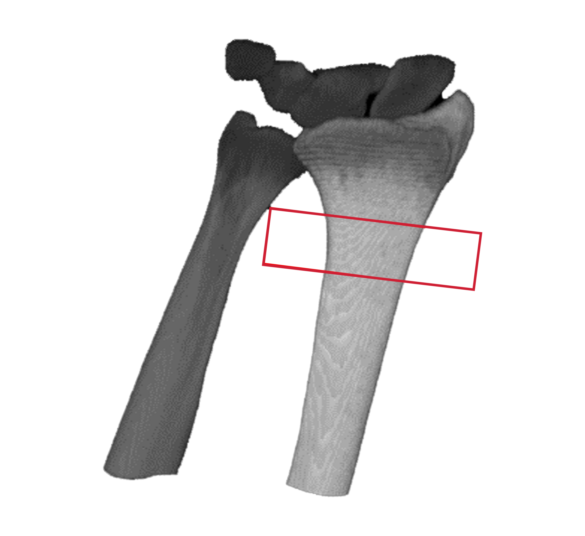 3D-Bone-Extraction-Web2 3D-Bone-Extraction-Web2