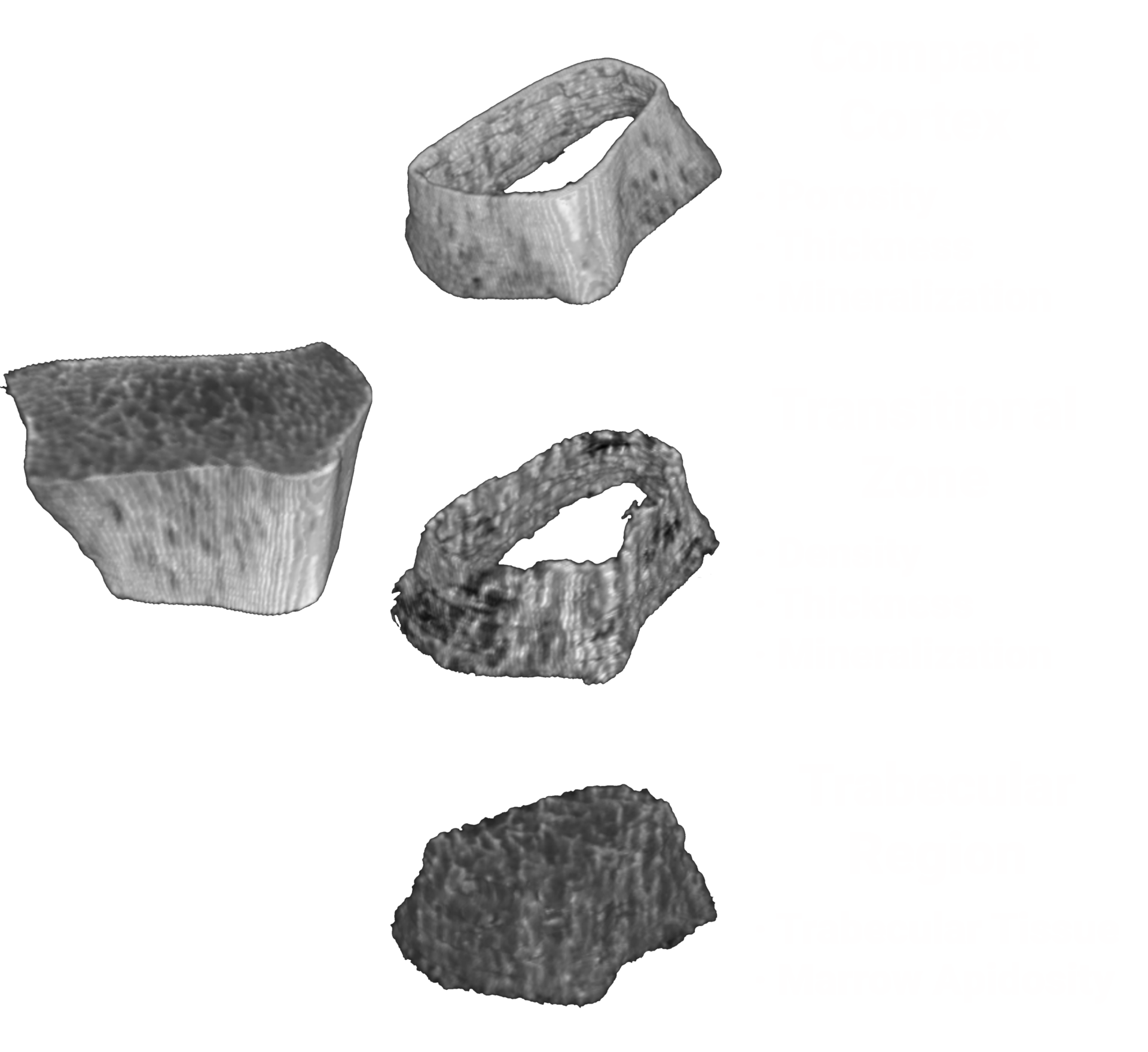Bone-Micro-SegmentationV2 Bone-Micro-SegmentationV2
