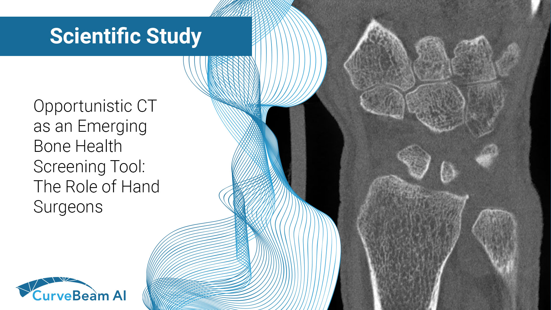HandBoneHealthPreview